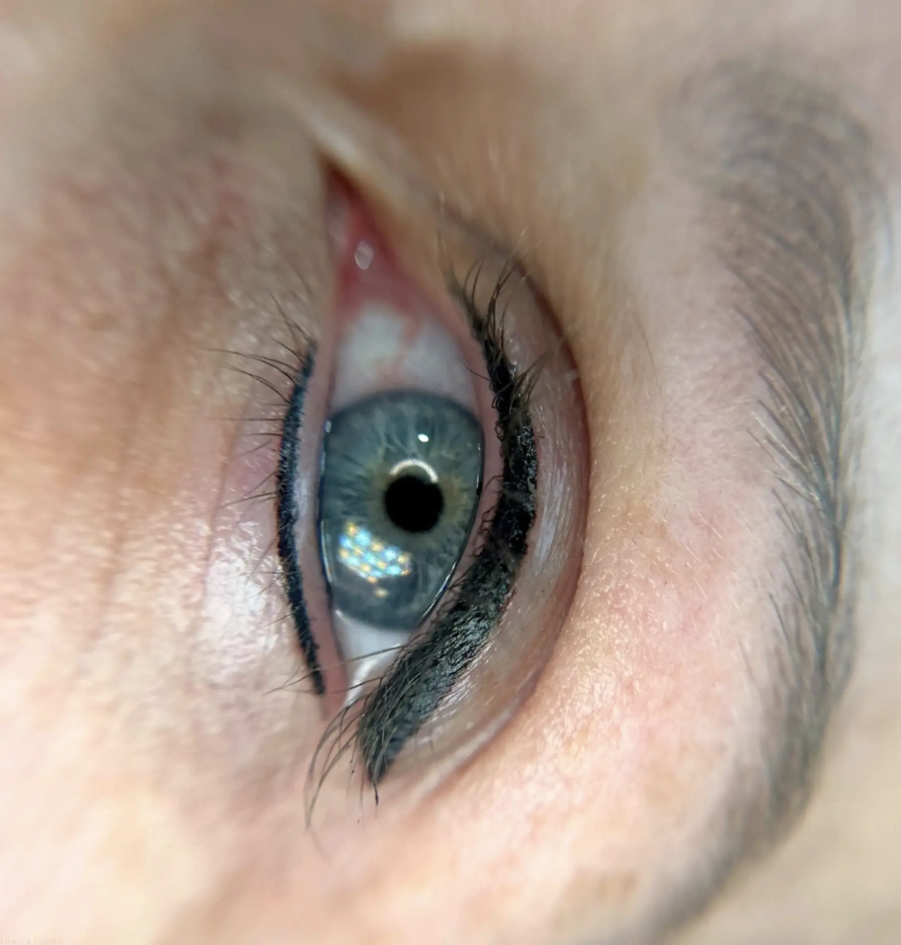 eyeliner tattoo complications