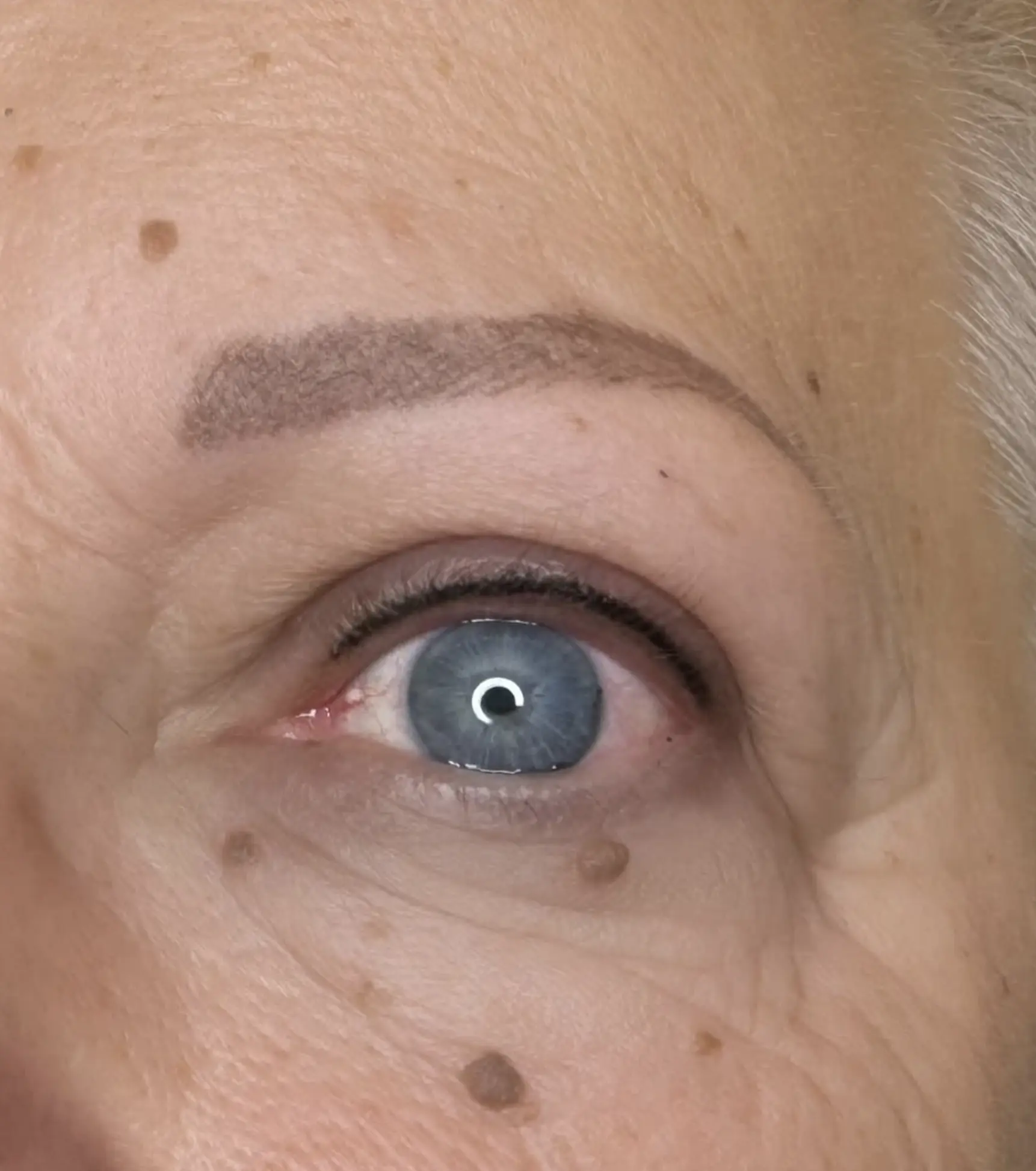 eyeliner tattoo infection