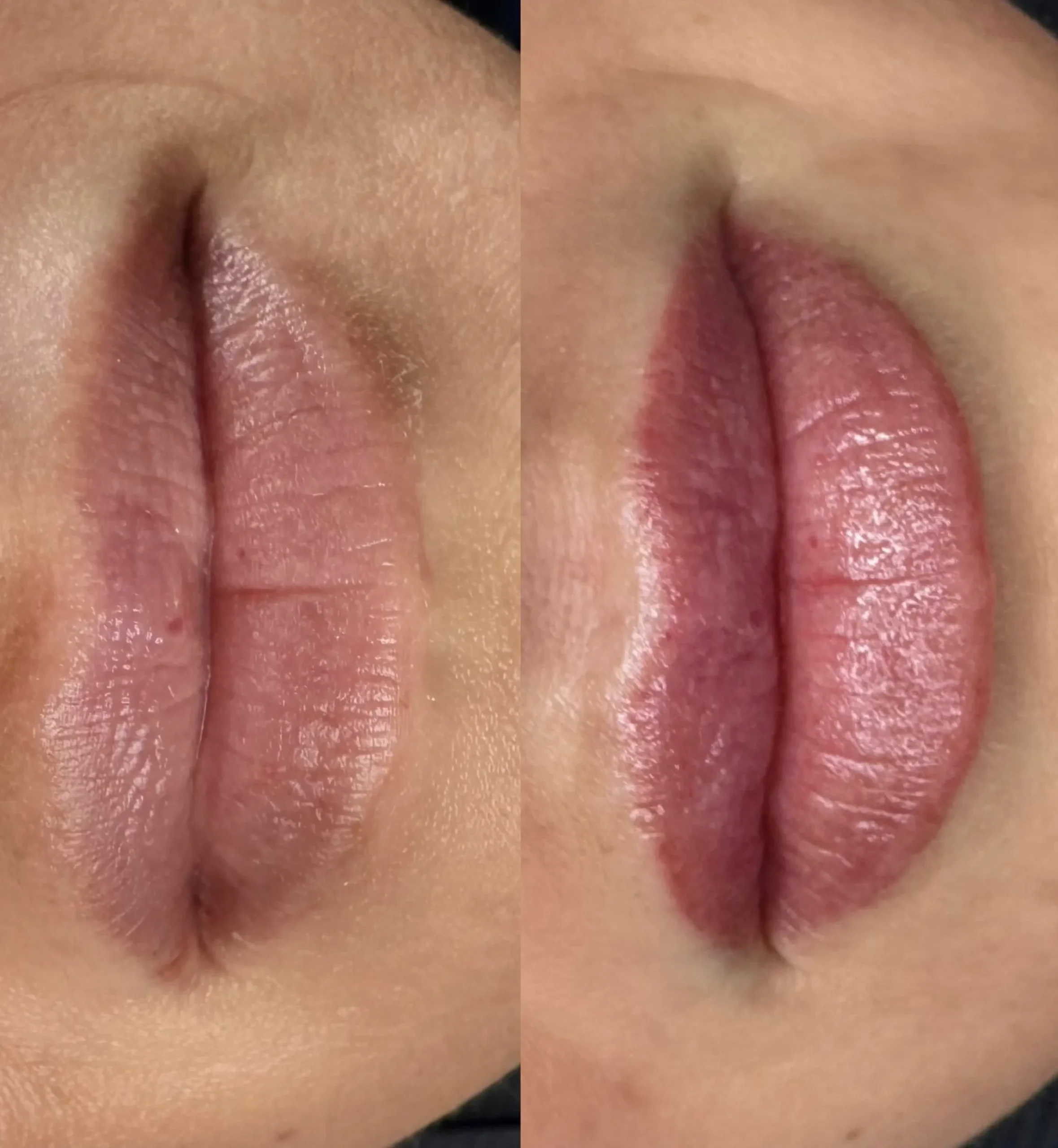 cosmetic tattoo healing process
